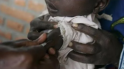 Over 6,000 Congolese killed by measles outbreak, WHO appeals for more funds