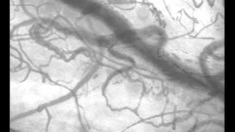 SDF imaging video clip