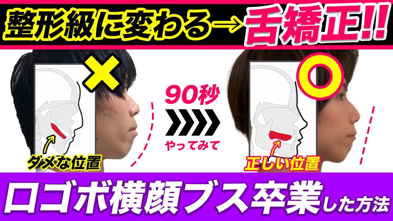 【新技:舌矯正】歯列矯正なしで口ゴボ・口呼吸・滑舌・歯並び改善!!整形並みに垢抜けた方法