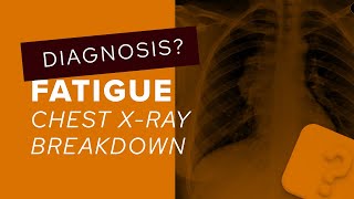Chest X-Ray breakdown: how to assess mediastinal contour screenshot 5