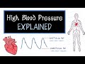 What is high blood pressure healthsketch