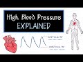 Understanding High Blood Pressure