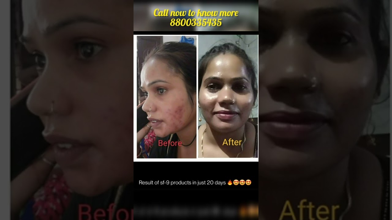 skin formula 9 and vestige supplements 