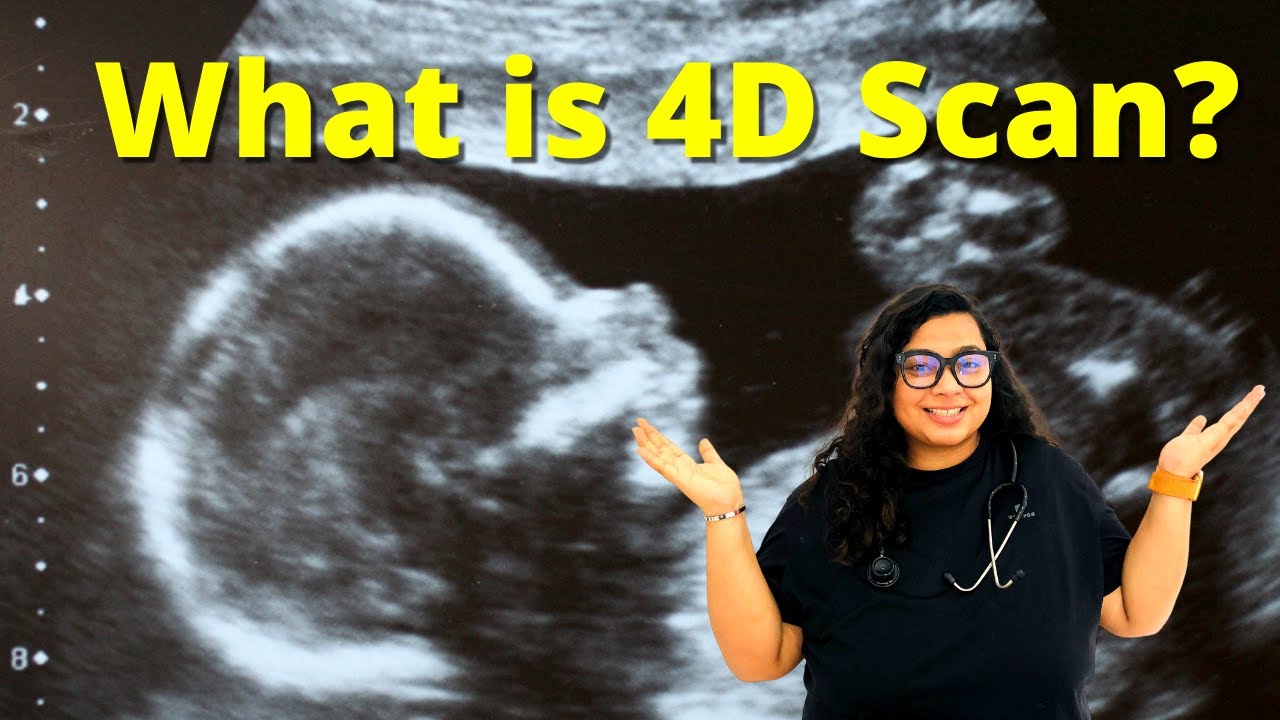 What Is 4D Scan Sonography And Pregnancy Explained YouTube what-is-4d-scan-sonography-and-pregnancy-explained-youtube
