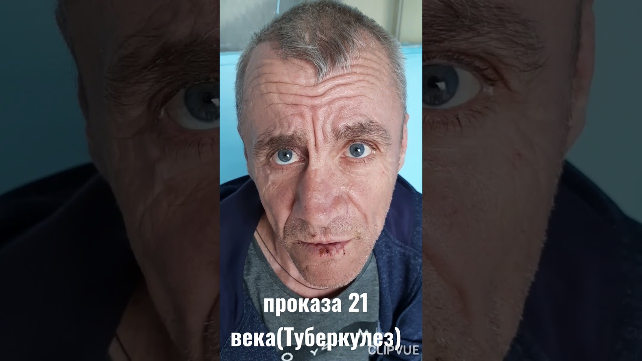 Проказа болезнь фото