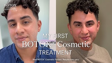 First Time Getting BOTOX® Cosmetic: Jeffrey Opens Up About the Experience