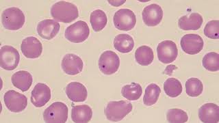 Howell Jolly Bodies Holly Jolly Bodies