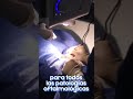 Profesiones expertos en oftalmología #shorts