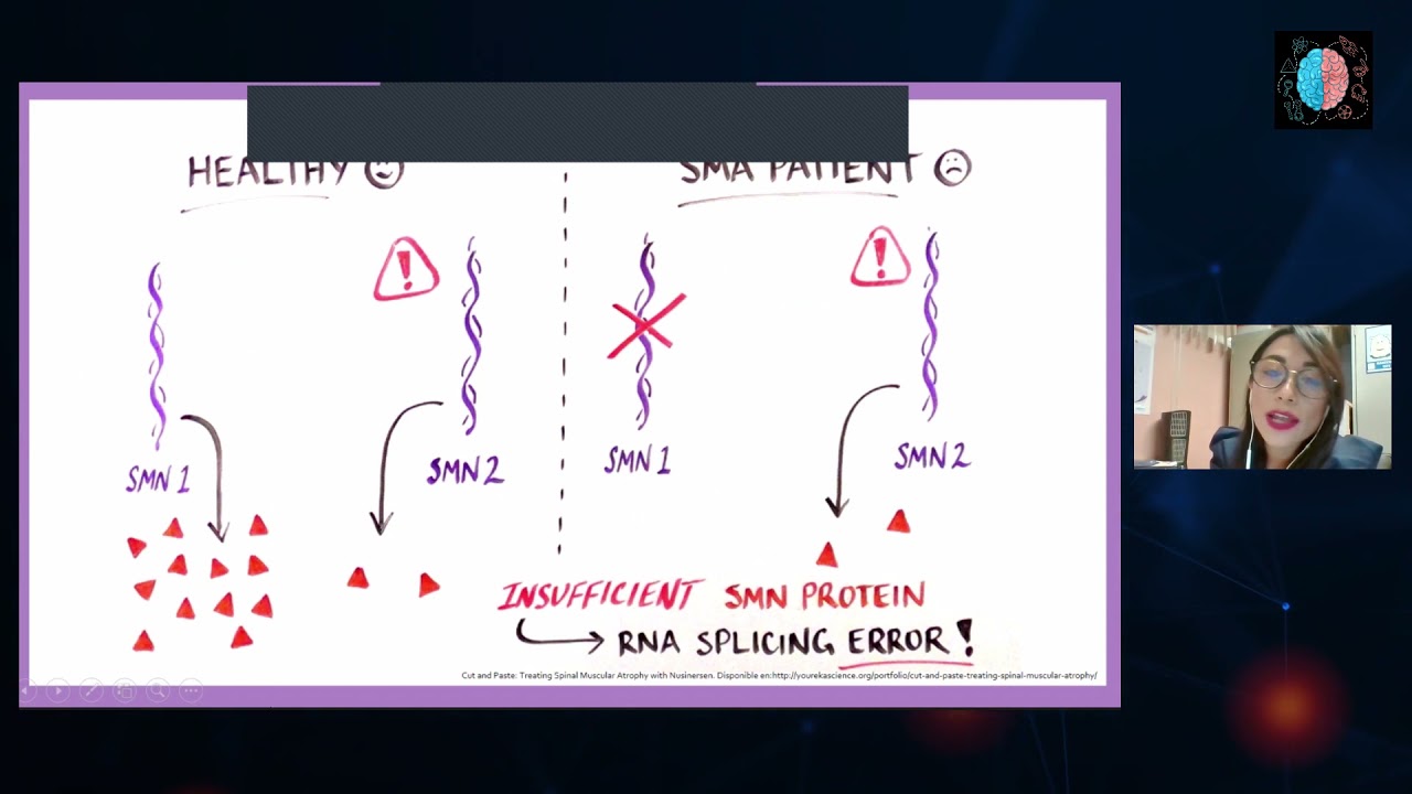 Experiencia en México para pacientes con Atrofia Muscular Espinal
