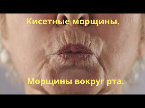 Кисетные морщины вокруг рта. Домашняя маска для губ от морщин. Омоложение губ.