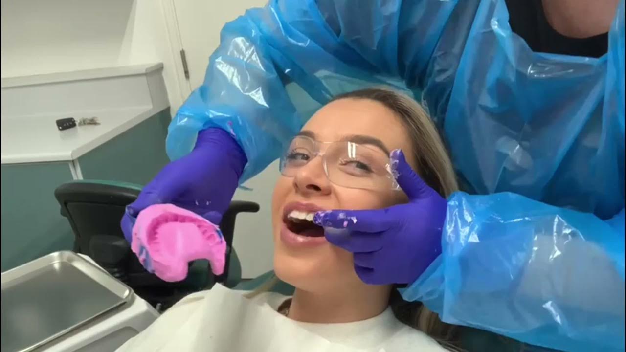 Alginate Impression Taking YouTube