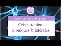 Crises tonicocloniques bilatrales