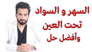 هل السهر سبب سواد تحت العين وما هو الحل - دكتور طلال المحيسن