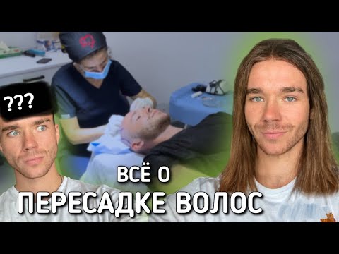 Моя ПЕРЕСАДКА ВОЛОС. Больно? Когда вырастут?