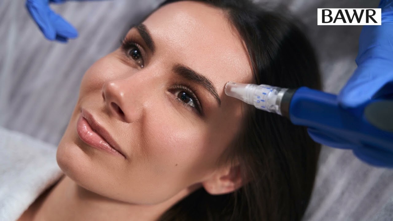 Microneedling in Dallas, TX: Get Glowing Skin Today