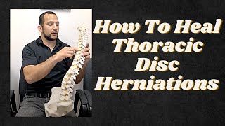 Thoracic Spine Disc Herniations