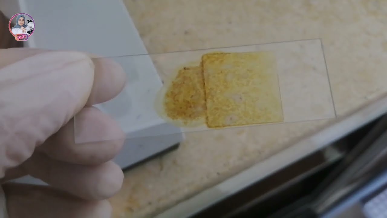 فحص عينة جديده mucoid stool under microscope