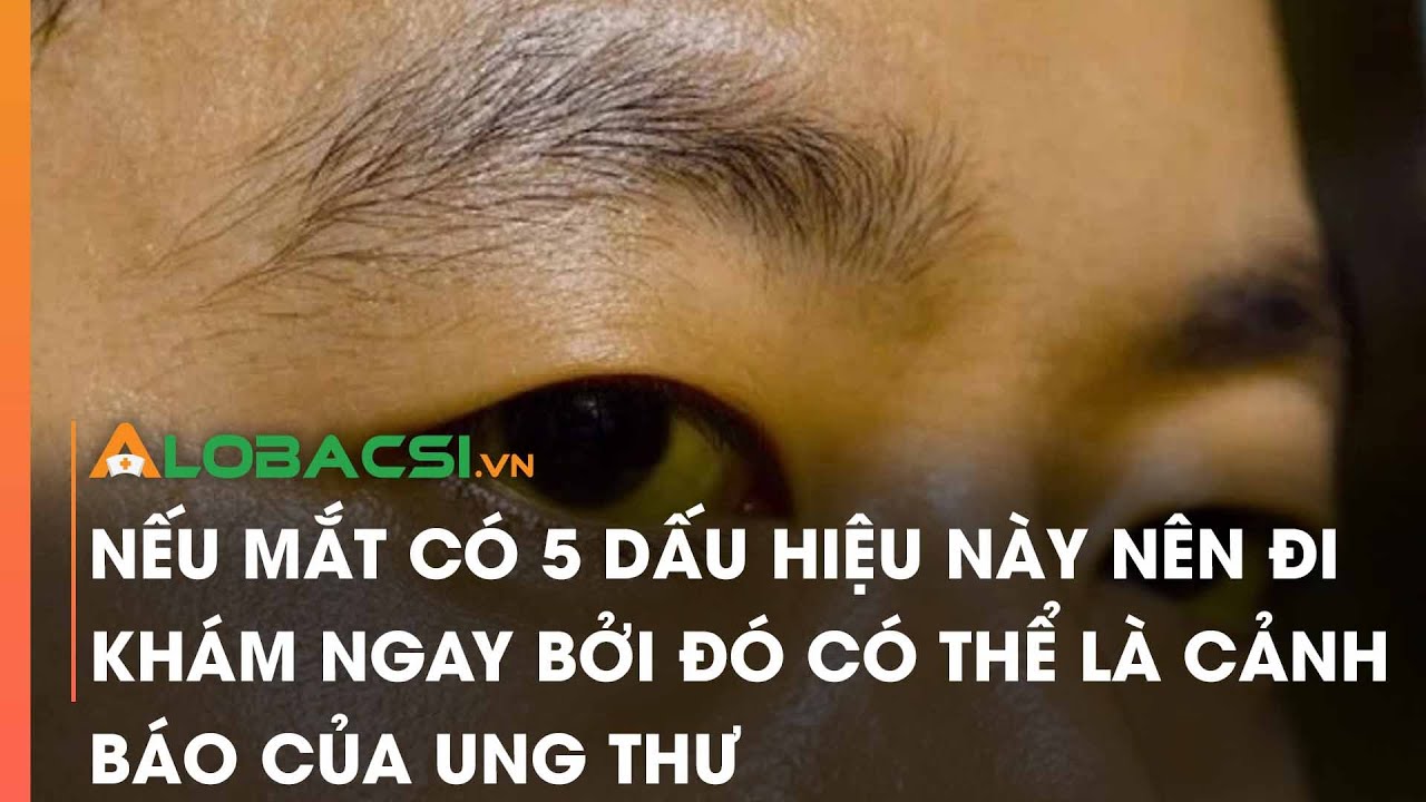 Nếu mắt có 5 dấu hiệu này nên đi khám ngay bởi đó có thể là cảnh báo của ung thư - youtube
