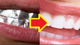 【衝撃】アルミホイルで歯を1時間覆うと・・・即実践！驚くべき効果が凄すぎる・・・