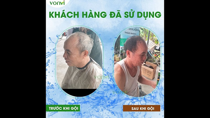 Lược nhuộm tóc thông minh giá bao nhiêu năm 2024