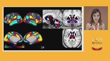 OHBM 2019 | Symposium | Global Signal vs Large - scale Spatiotemporal Patterns: Sorting out co…