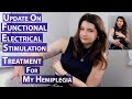Update on my functional electrical stimulation treatment (FES) for my hemiplegia (my disability)