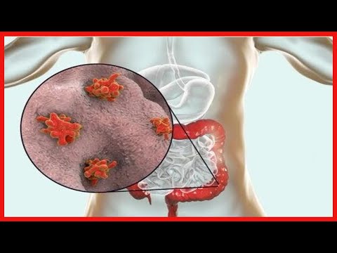 Video: ¿Qué enfermedad es causada por un protozoario?