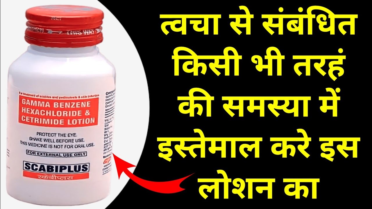 scabiplus lotion scabiplus lotion ke fayde scabiplus lotion