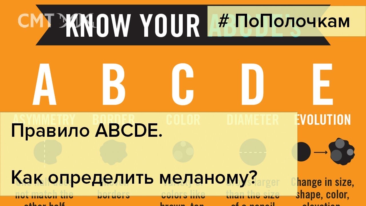 Правило ABCDE. Как определить меланому? - YouTube