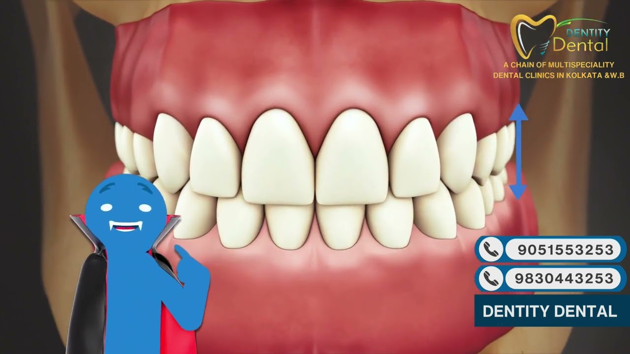 Anatomy of the Canines | Dentity Dental Explains Tooth Structure & Function