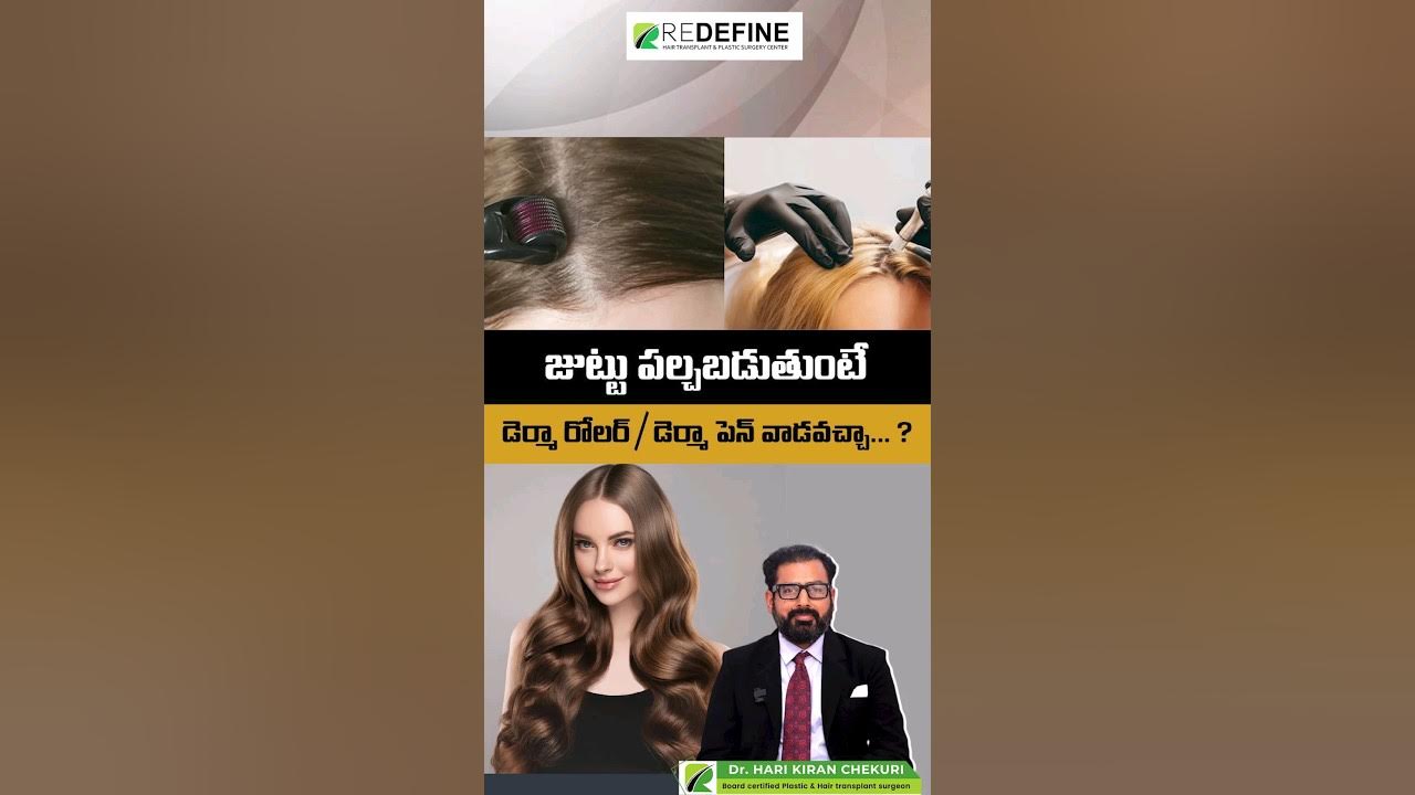 Hair Thinning Treatment Telugu microthinning haircaretips shorts hair-thinning-treatment-telugu-microthinning-haircaretips-shorts
