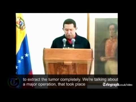 Video: Hugo Chavez Nettowaarde: Wiki, Getrouwd, Familie, Bruiloft, Salaris, Broers en zussen
