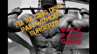 Fix That Herniated Lumbar Disc Without Surgery | Trevor Bachmeyer | SmashweRx