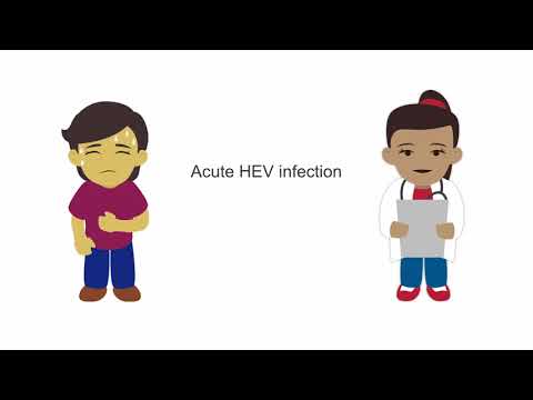 How to diagnose a hepatitis E infection.