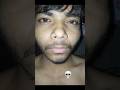 Natural beard growth 11 week journey 📈📈#man matters #minoxidil