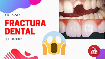 ¿Qué hacen los dentistas con un diente arrancado?