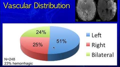 ISMRM MR Academy: Imaging in Stroke