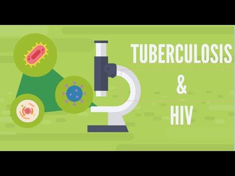 TB and HIV