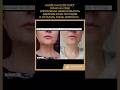 Отзыв коллеги-косметолога на американские пептиды - попробовала на себе #cosmetology #peptides