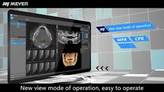 Meyer New version of 3D diagnostic software screenshot 5