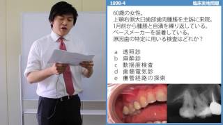 慢性根尖性歯周炎をマスターしよう【109回歯科医師国家試験-B4】