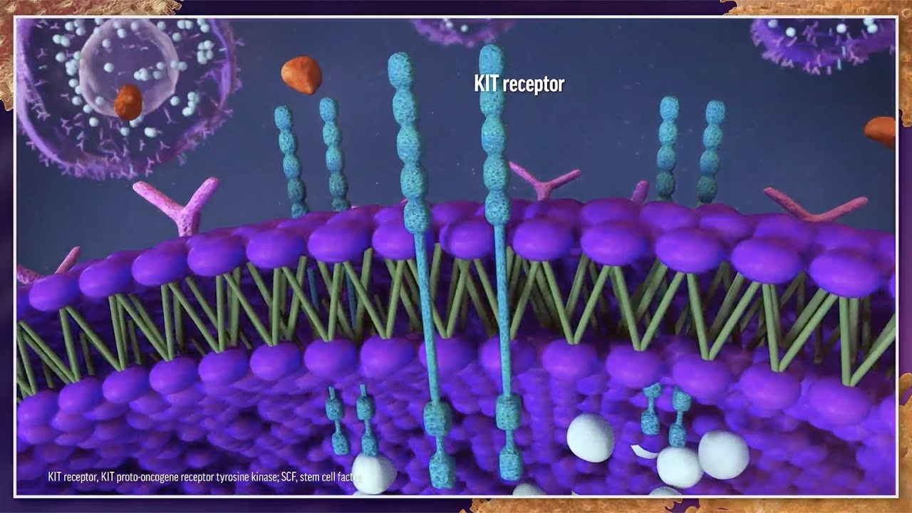 Is It Systemic Mastocytosis? Best Practices for Diagnosis and Management