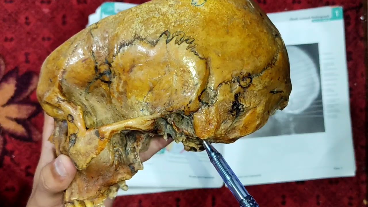 Norma Lateralis || Skull Osteology || Suprameatal Triangle || Tympanic Plate