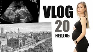 VLOG: ГОСПИТАЛЬ и УЗИ 20 НЕДЕЛЬ БЕРЕМЕННОСТИ