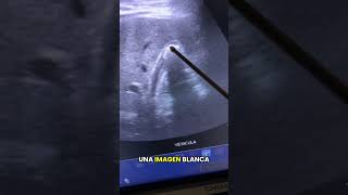 Un simple control reveló más de 5 patologías