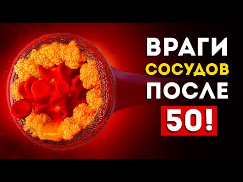 Эти продукты забивают сосуды после 50 лет (Исключите их из рациона)