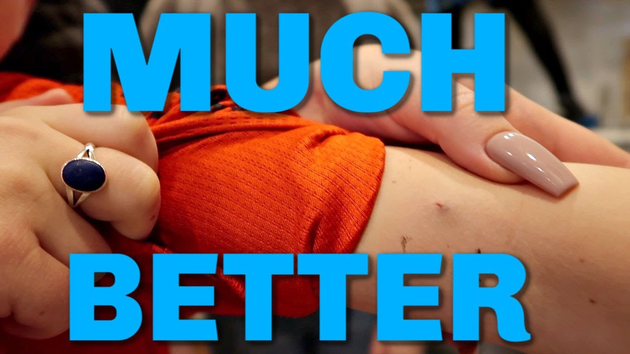 Boston's Surgery Success