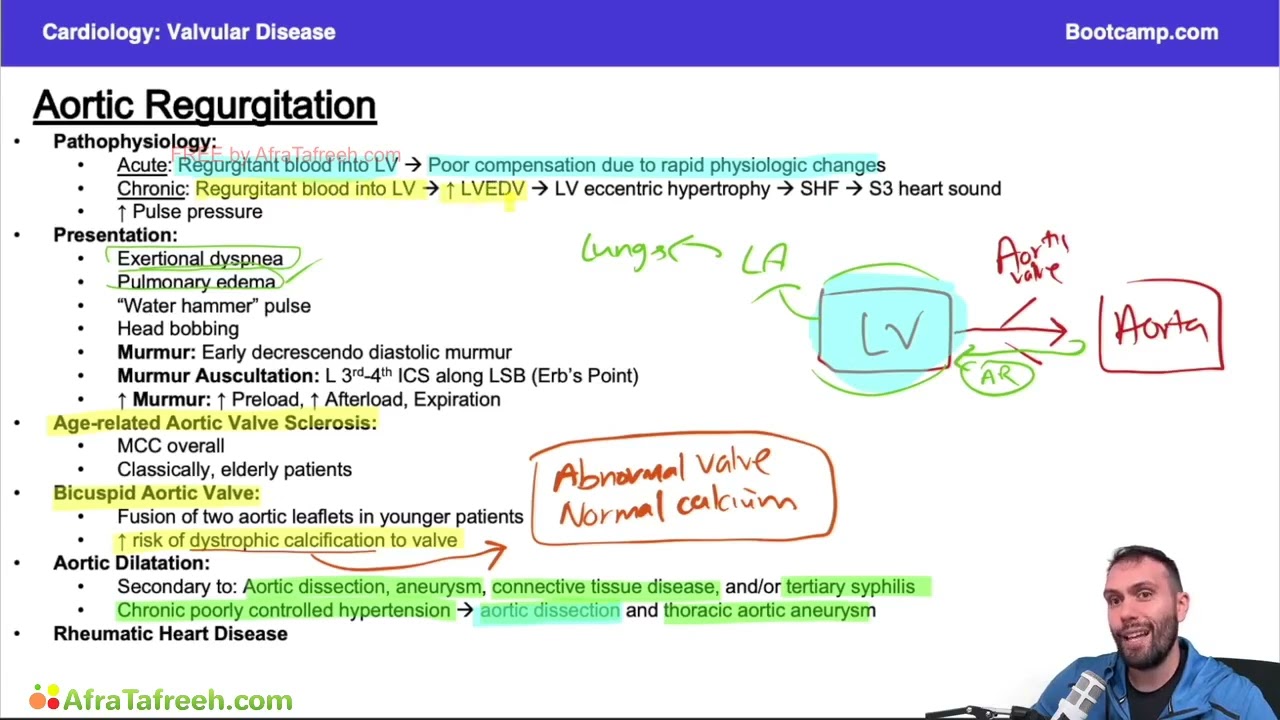 Aortic Regurgitation || Valvular disease || Cardiology 
