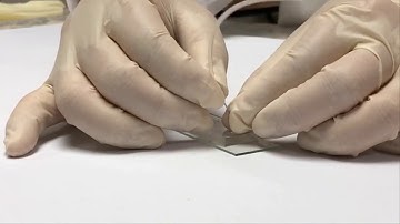 IWIS 2020 - ID148 - Microfluidic chip for microfilaria detection