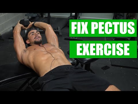 The Dumbbell Pullover for Sunken Chest Treatment (Pectus Excavatum)